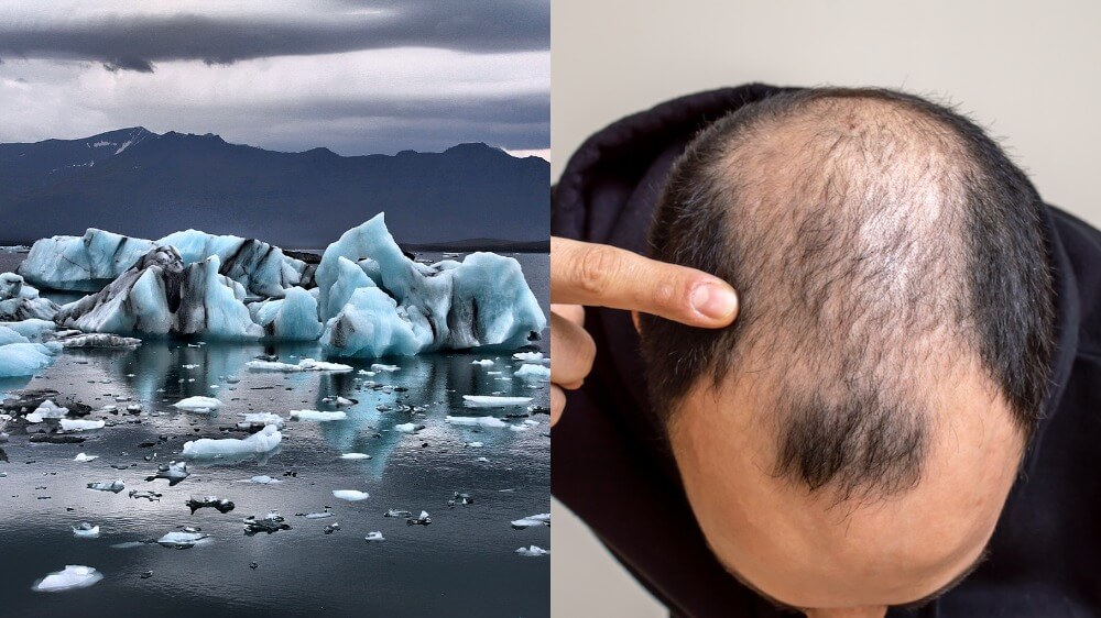 Glacier Hair